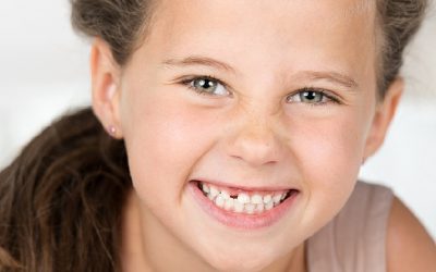 How To Survive The ‘Losing First Tooth’ Milestone Healthily